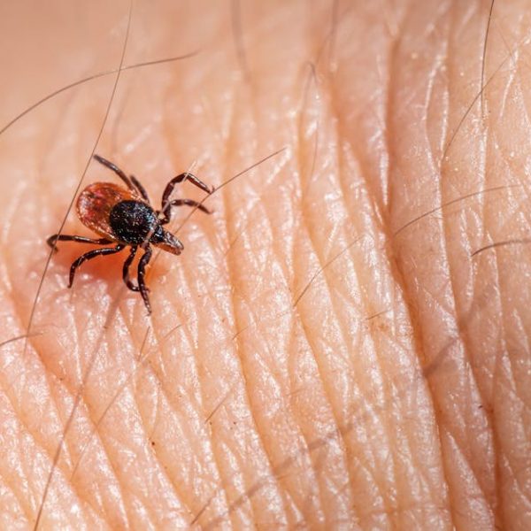 Where to Buy or Make Black Castor Oil: Your Complete Guide